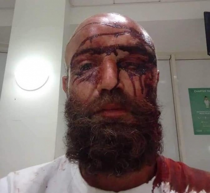 Youth, charged over assault on taxi driver, released on bail