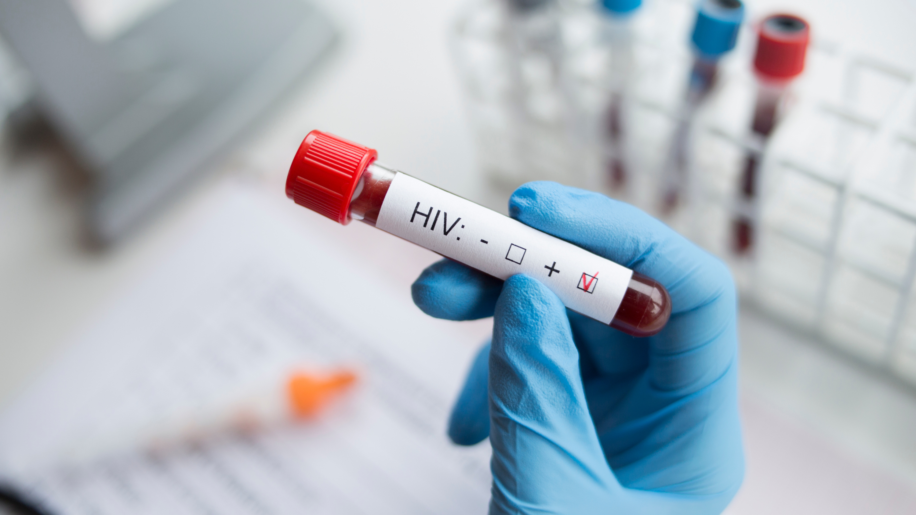 As of June 2025, Malta has a significant total of 754 active cases of people living with HIV, with 2024 seeing 113 new HIV diagnoses