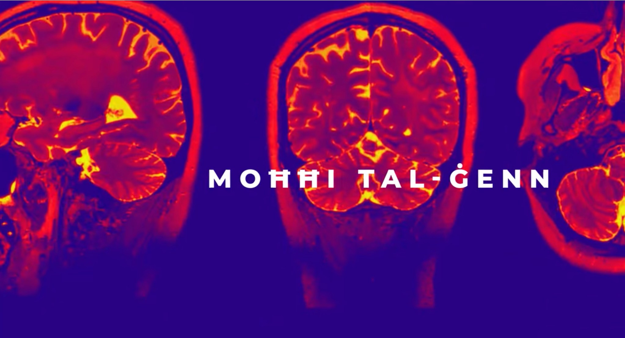 WATCH | Moħħi tal-Ġenn: A new documentary on the unheard stories of mental health
