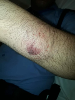 Homeless man who bit police officers remanded in custody