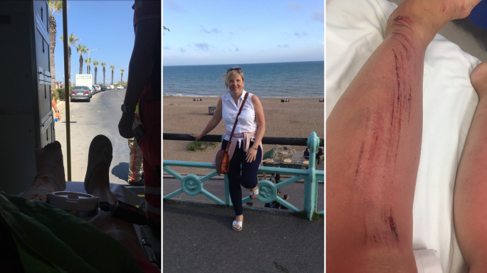 Holiday from hell: How slime sent an English tourist home on crutches