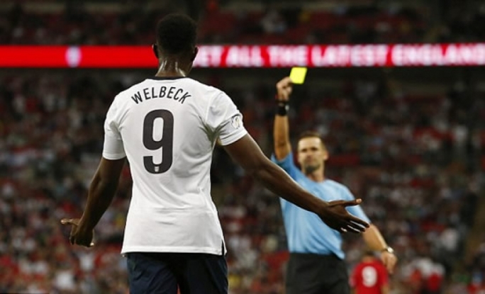 Injury scare for England's Welbeck