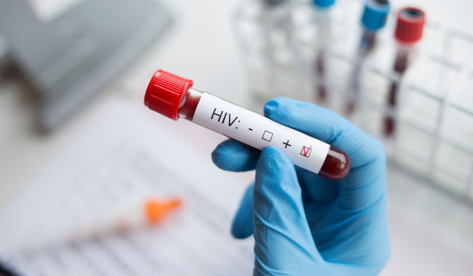 NGOs urge government to fulfil promise on HIV medication